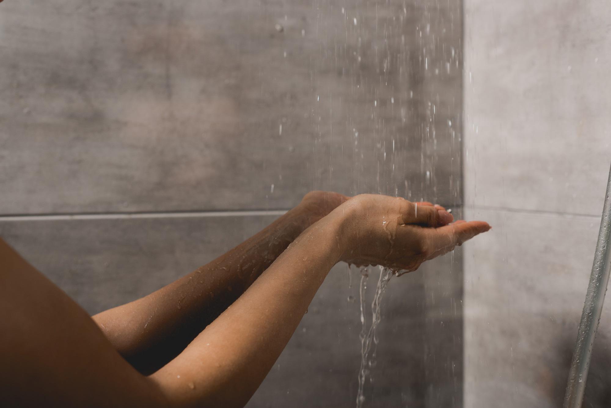 Allergia all'acqua, la storia di Tessa: "Ecco cosa mi succede sotto la doccia"