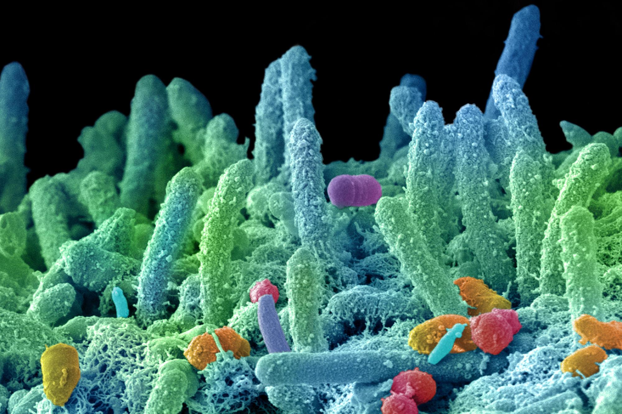 Antibiotico resistenza, Bassetti: "Oltre 80 milioni per finanziare lotta a super batteri"