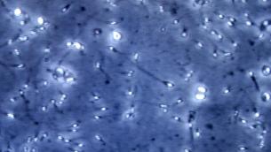 Caldo mette a rischio fertilità maschile, i consigli degli esperti