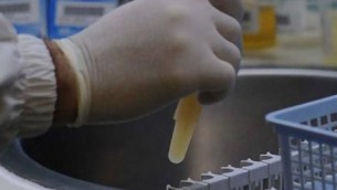 Cancro al colon, sotto accusa il batterio Escherichia coli