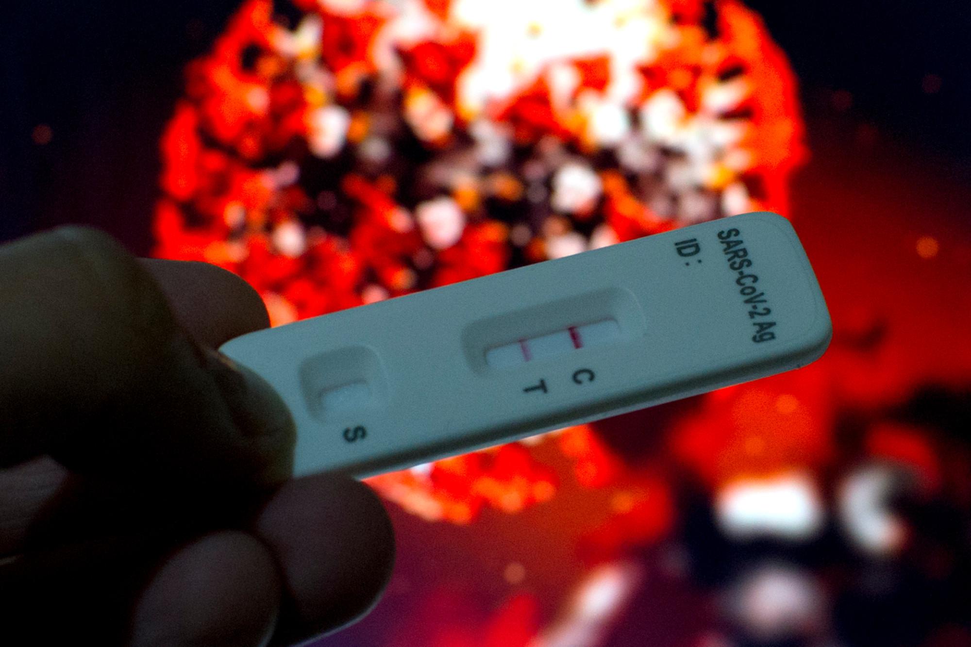 Covid, caso di doppio contagio: Omicron dopo 20 giorni Delta