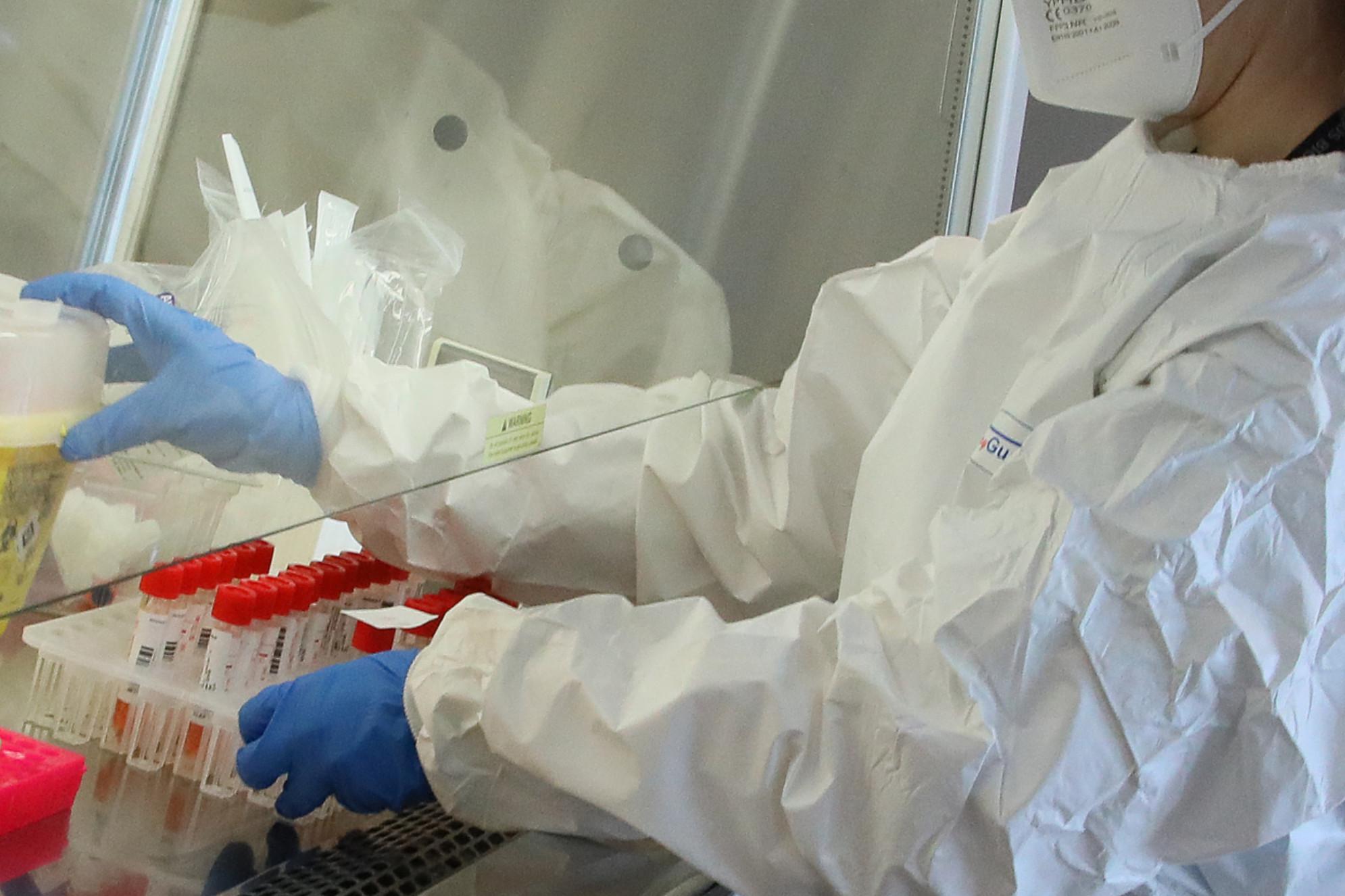 Covid, "così si blocca il virus nelle cellule"