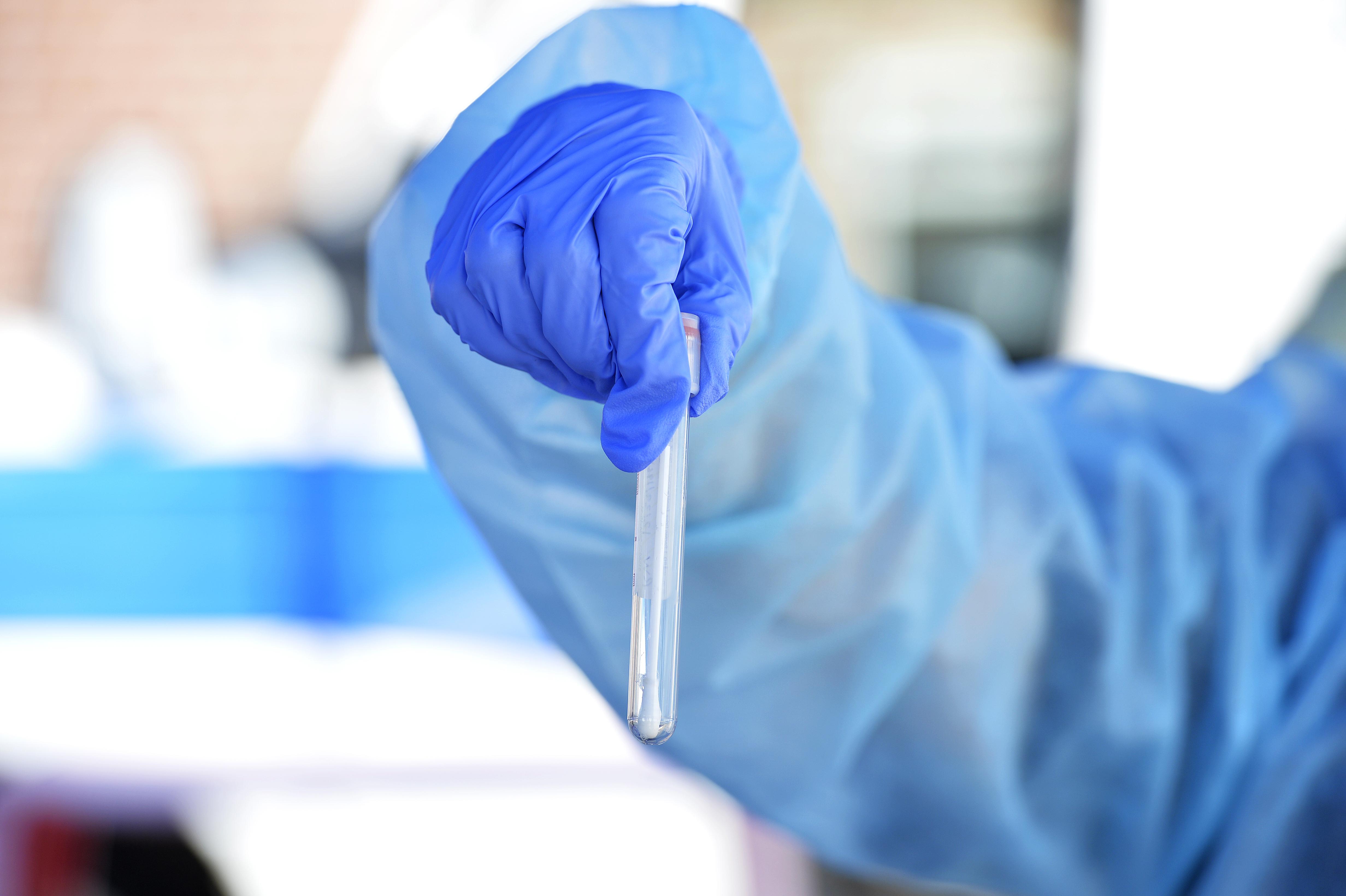 Covid, immunologo Le Foche: "Con variante Kraken sarà record di contagi"