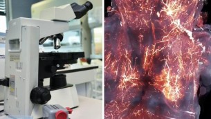Covid invade il cervello, ecco il 'film'