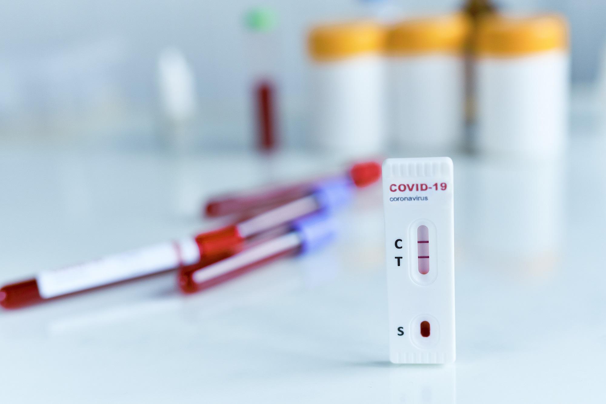 Covid Italia, contagi raddoppiati in 3 settimane: crescono ricoveri e morti