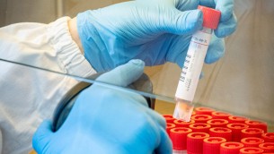 Covid Italia, Iss: Rt sale, ricoveri in calo