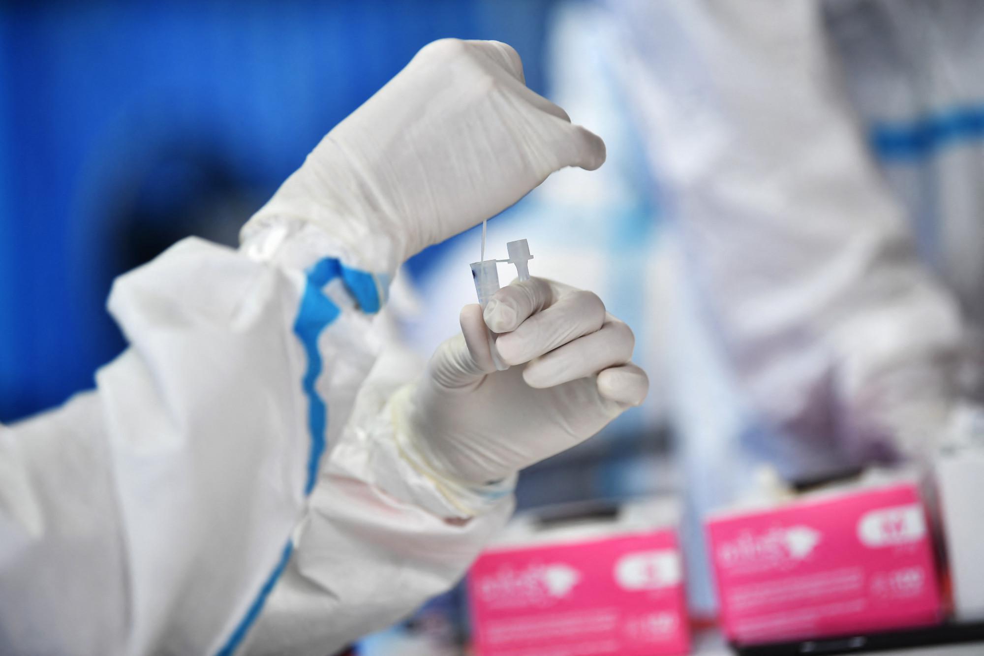 Covid oggi Italia, Crisanti: "Sì a mini-quarantena con test negativo"