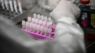 Covid, Oms: più di 1,4 milioni i nuovi casi