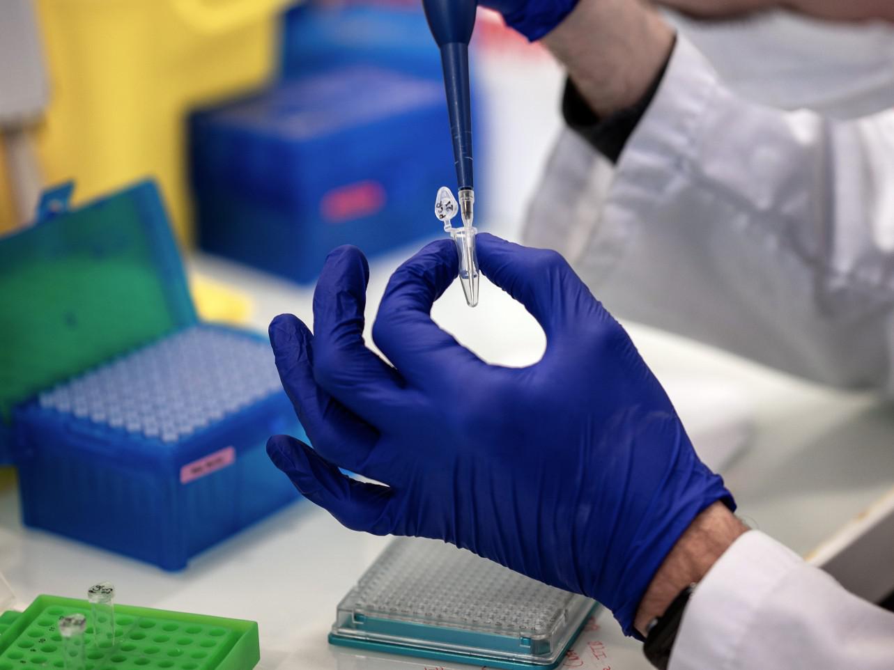 Covid, quanto è infettivo un malato? Tecnica italiana lo misura