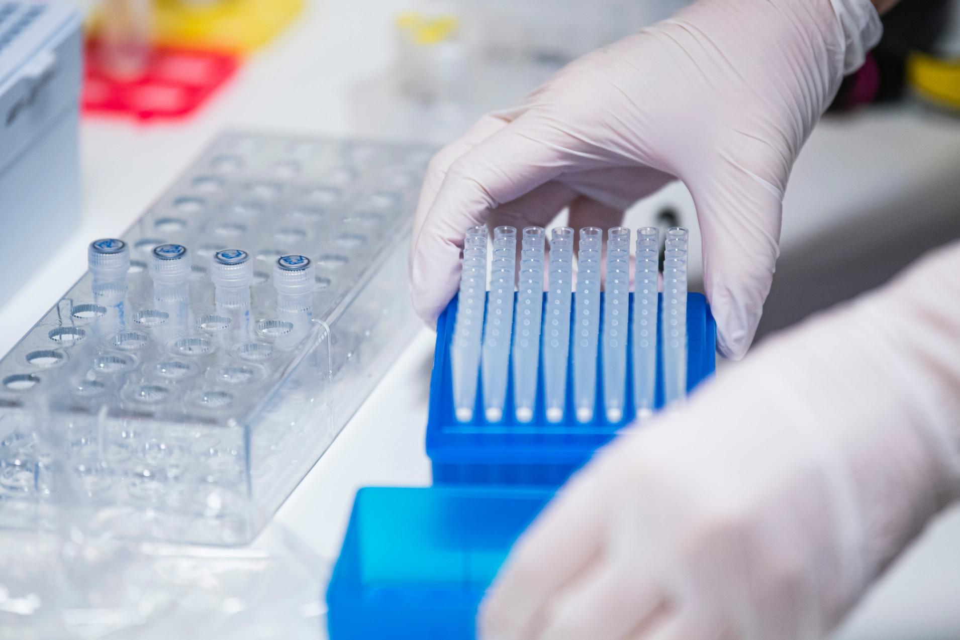Covid, rischio diabete correlato al virus