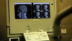 Disonesti e bugiardi, gli interruttori nel cervello
