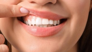 Disturbi gengivali per 60% italiani, esperti: "Prevenzione un investimento"