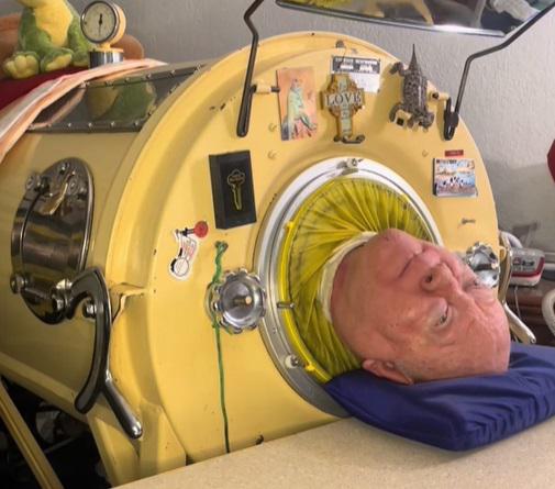 E' morto Paul Alexander, aveva 78 anni: per tutta la vita nel polmone d'acciaio