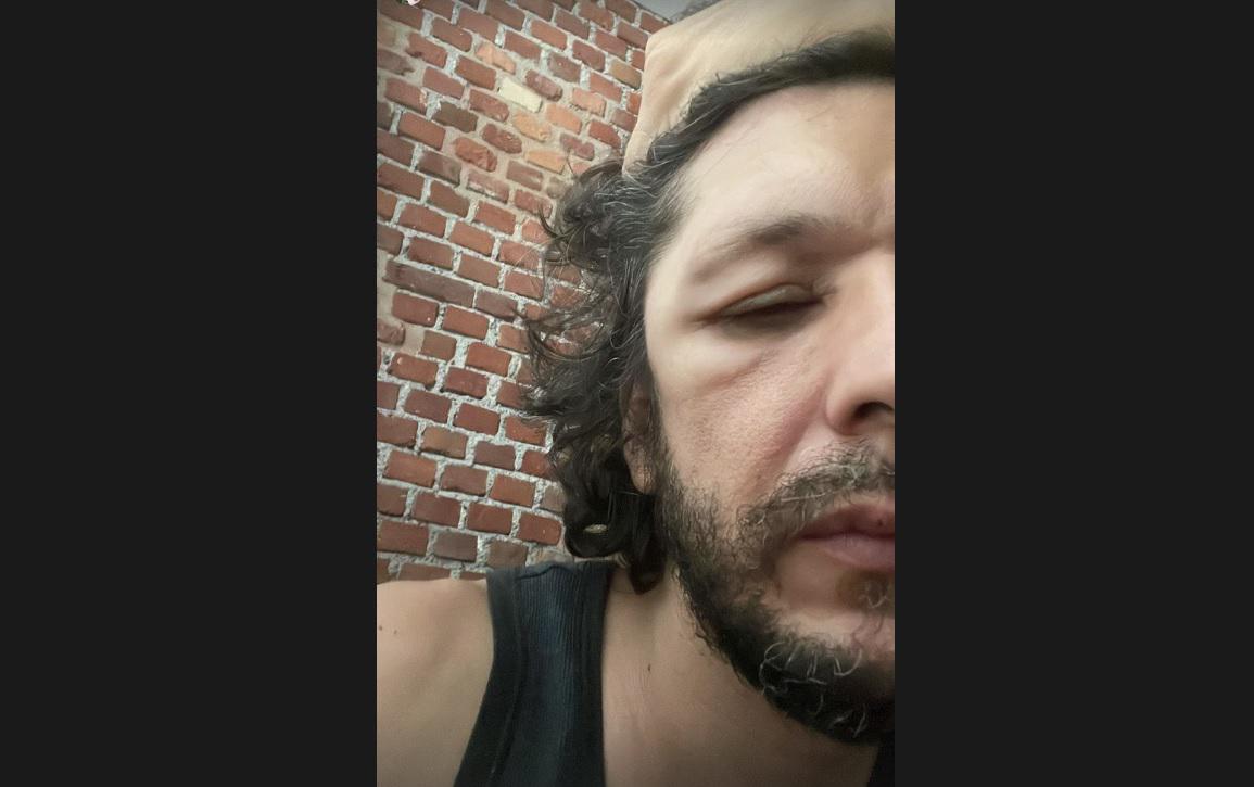 Ermal Meta annulla concerti: "Ma non sto morendo..