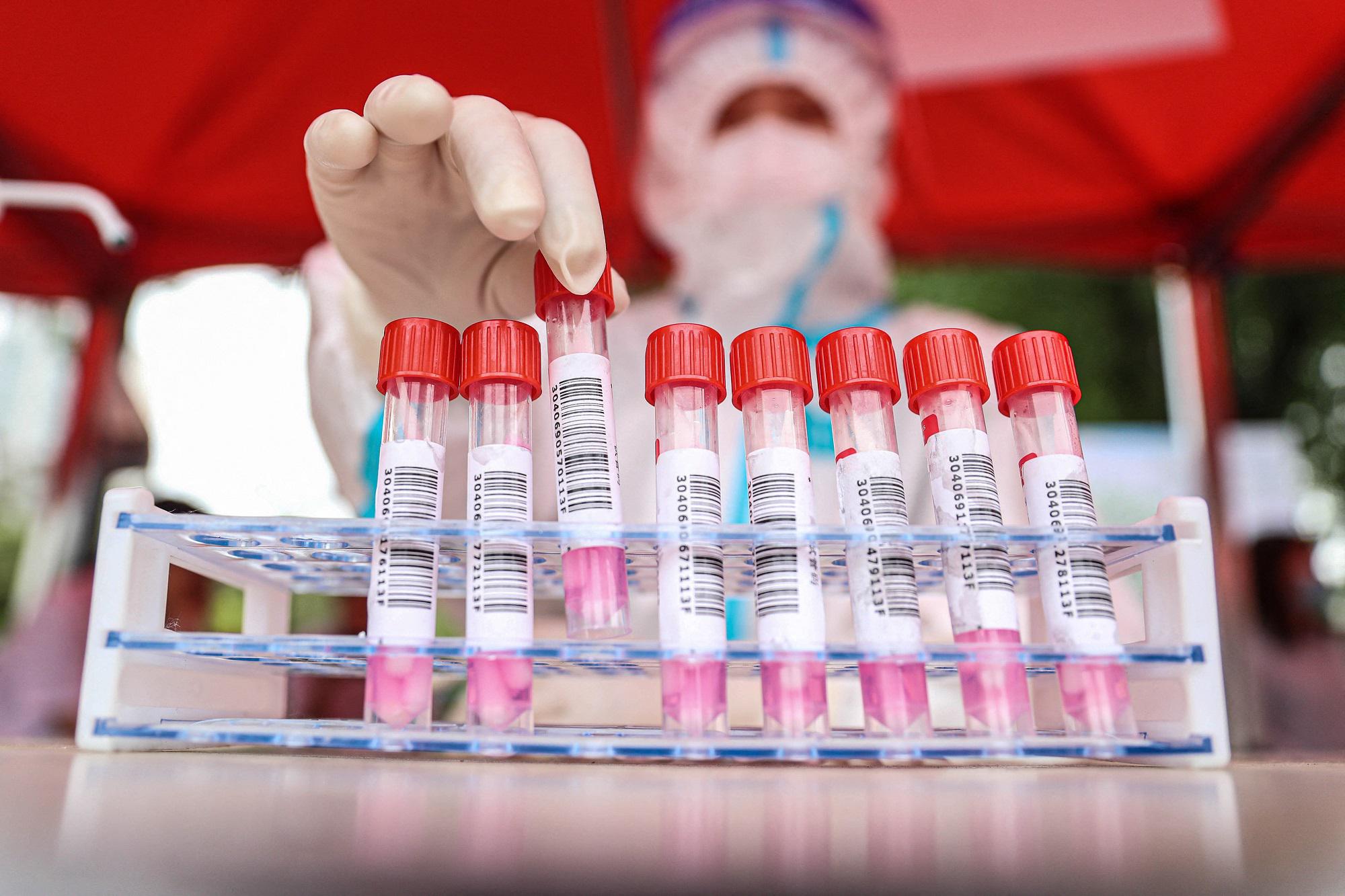 "Il Covid diventerà endemico, pandemia tutt'altro che finita"