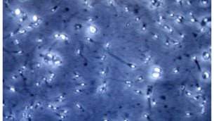 Infertilità maschile, dietro c'è gene mancante: spermatozoi sono 'sconnessi'