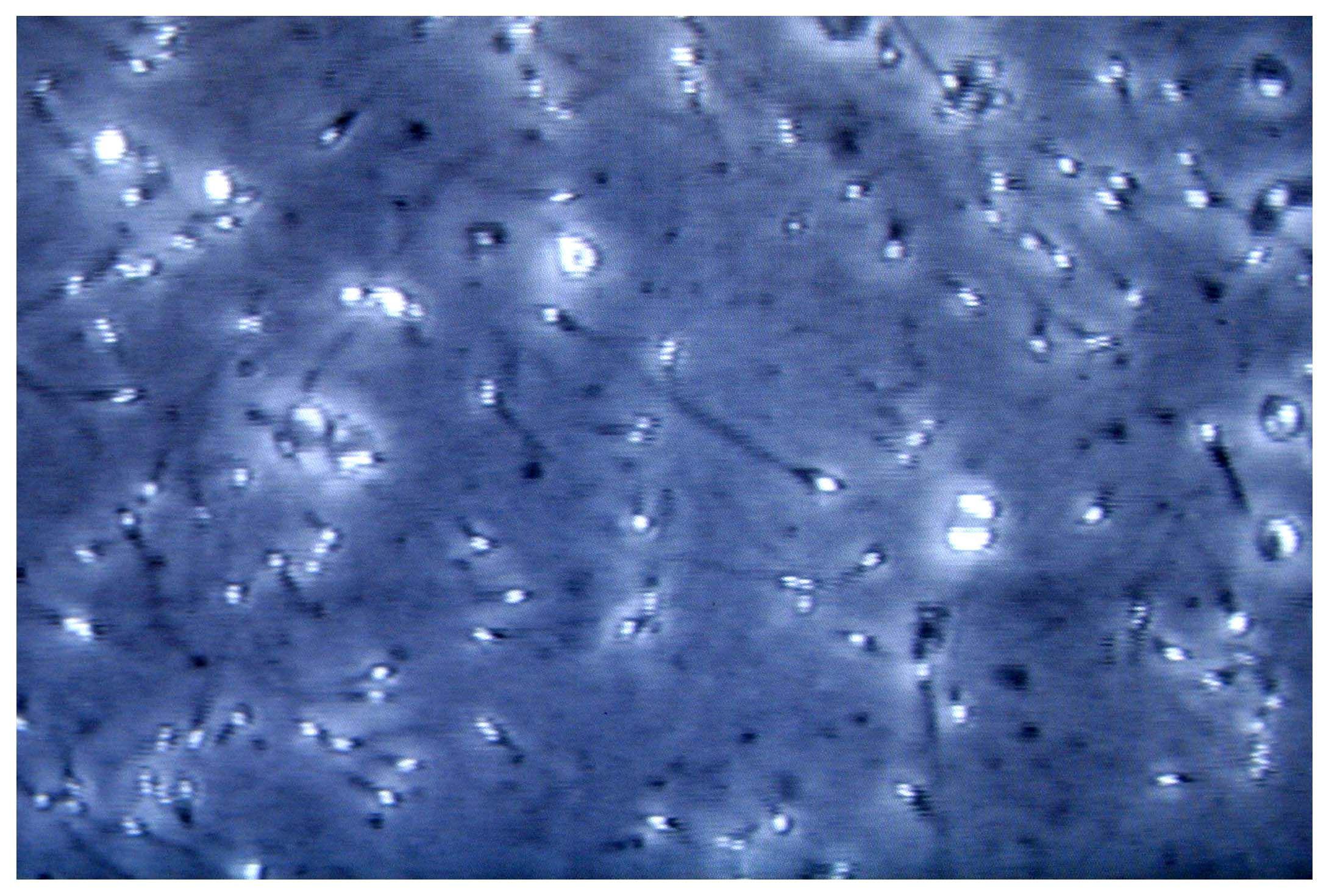 Infertilità maschile, dietro c'è gene mancante: spermatozoi sono 'sconnessi'