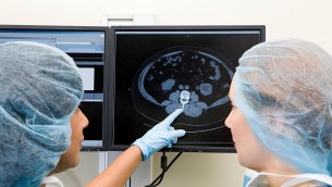 Kinsella e il cancro al cervello, cos'è il glioblastoma che l'ha colpita