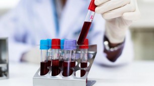 Malattia misteriosa Congo, ipotesi malaria: quali sono i sintomi