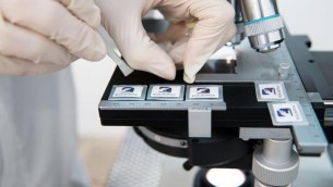 Malattie neurodegenerative, arriva dispositivo nanotech tutto made in Italy
