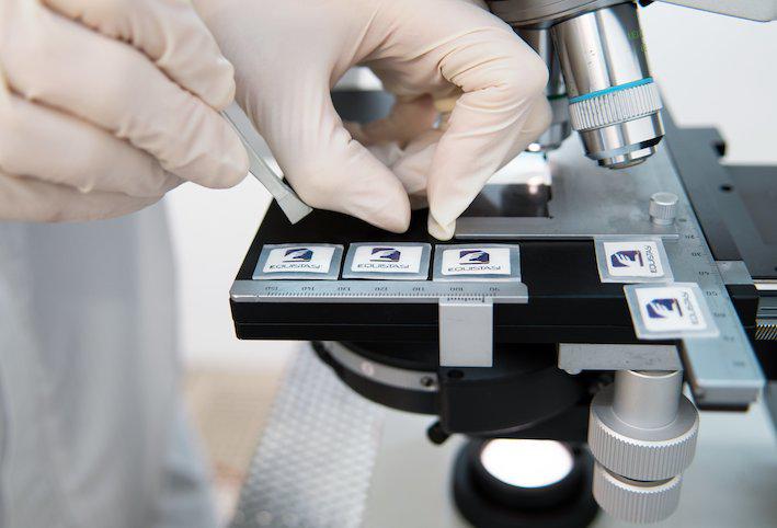 Malattie neurodegenerative, arriva dispositivo nanotech tutto made in Italy