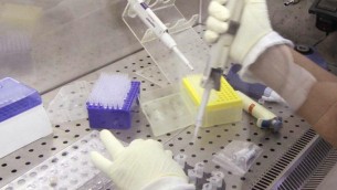 Malattie rare, scoperta causa sindrome della 'bimba di pietra'