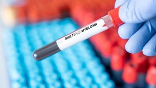 Mieloma multiplo, in Italia disponibile nuovo trattamento