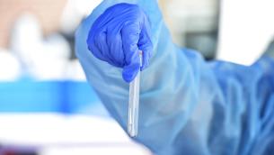 Omicron 2, sottovariante anche in Italia: cosa sappiamo