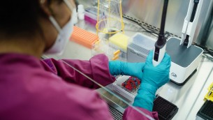 'Relazione pericolosa' tra Covid e trombosi, italiani scoprono recettore chiave