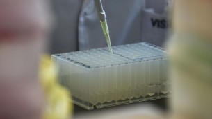 Tumori, mix farmaci-vitamina C efficace contro linfomi più aggressivi: studio Ieo