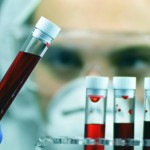 Tumori, Ue approva terapia per adulti con leucemia linfatica cronica refrattaria