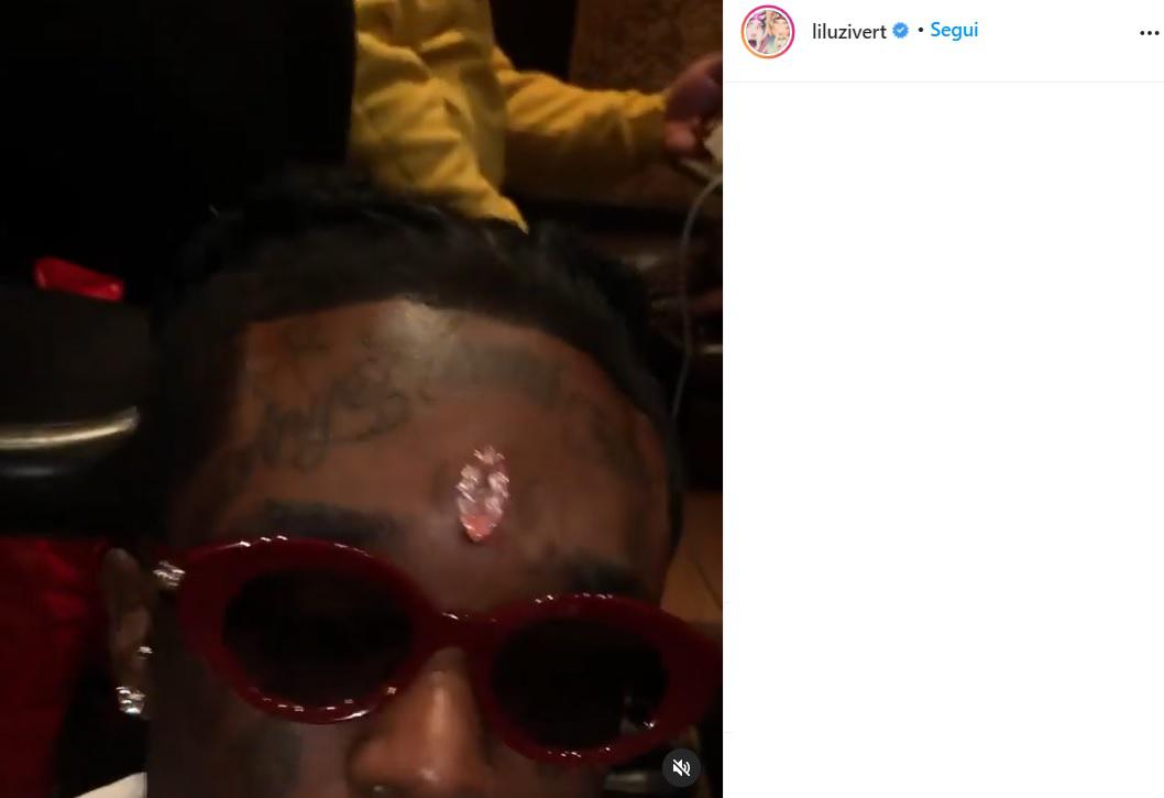 Un diamante in fronte, il rapper spende 24 milioni