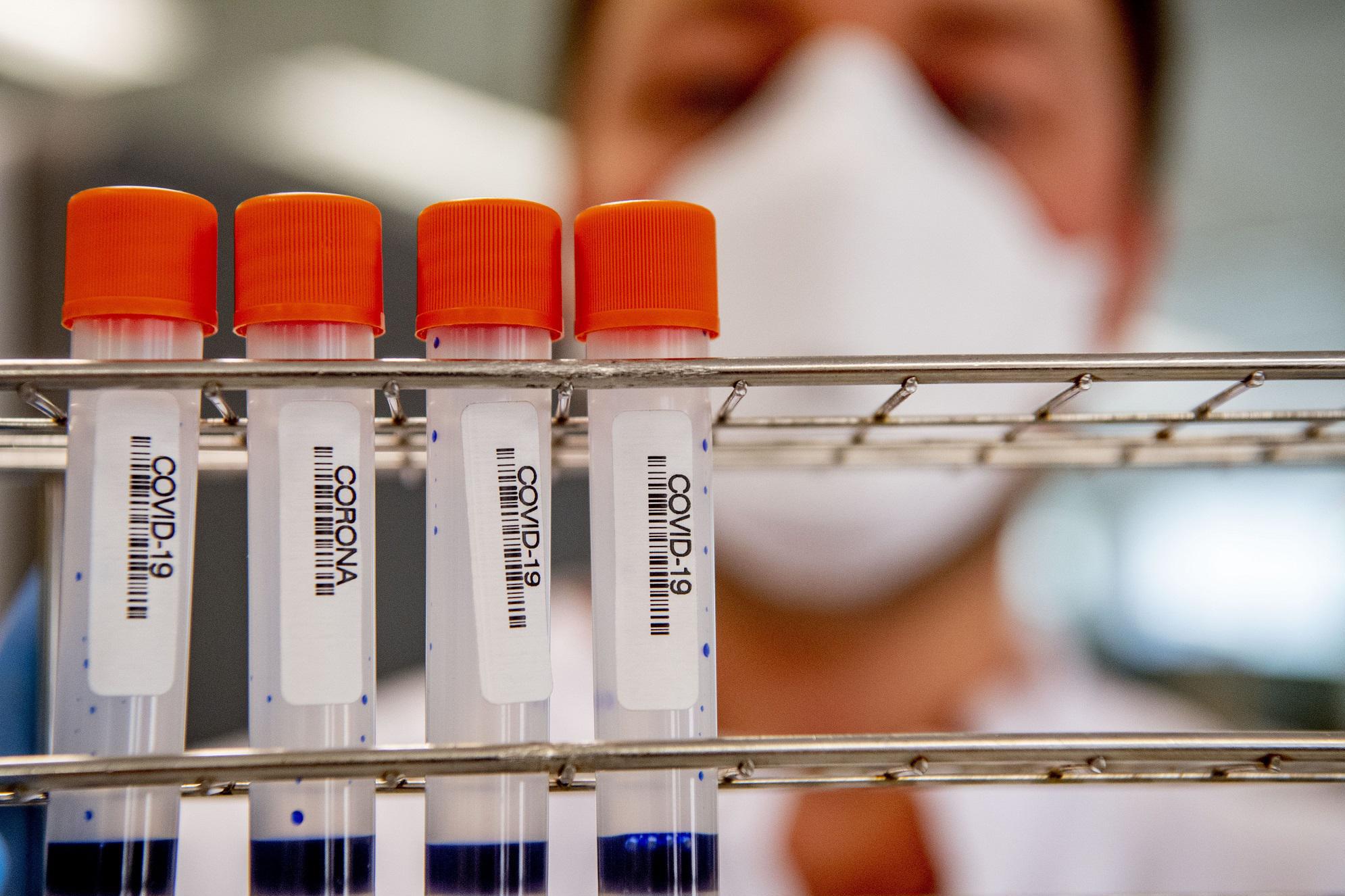 Variante Omicron, incubazione dura 3 giorni: studio