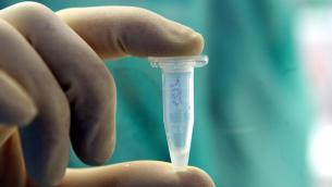 Virus Marburg, cos'è e sintomi: perché se ne riparla