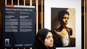 World Press Photo, nella foto dell'anno un bambino mutilato a Gaza