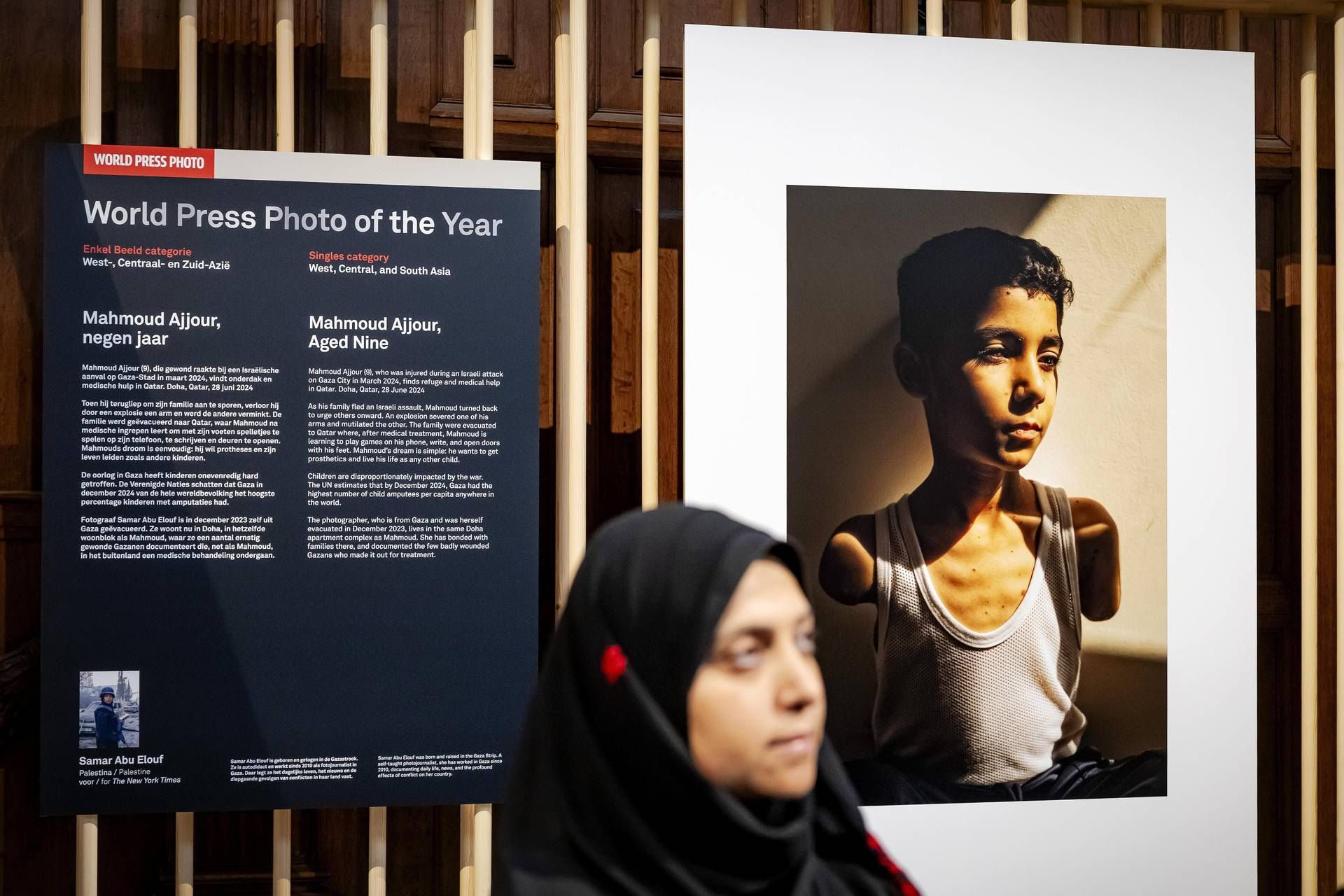 World Press Photo, nella foto dell'anno un bambino mutilato a Gaza