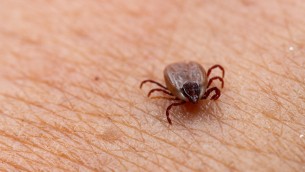 Zecche e Sindrome alfa-Gal, cos'è l'allergia che allarma gli Usa